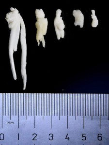 Image right: An array of vestigial teeth collected from narwhals. (Photos courtesy Martin Nweeia)