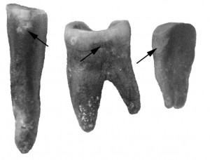 Henry-Brooks-Piperno-Fig-S1