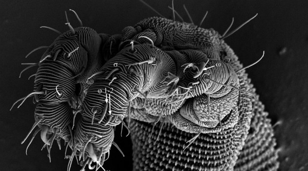 The front end of Osperalycus tenerphagus showing three of its legs and the unusual structure of its skin. (Photo courtesy Samuel Bolton)